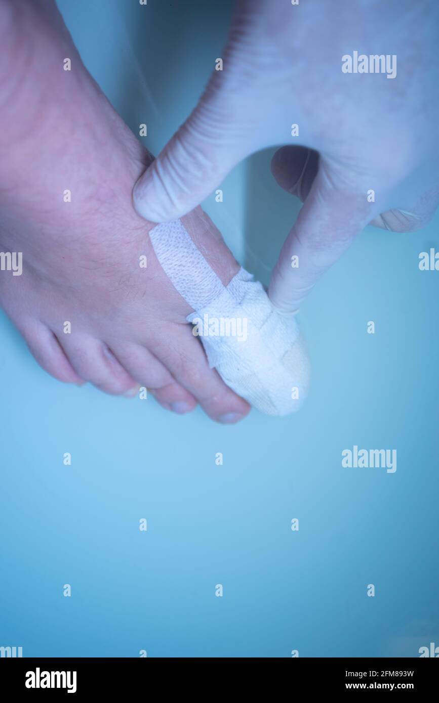 Foot big toe bandage injured feet in medical clinic hospital center