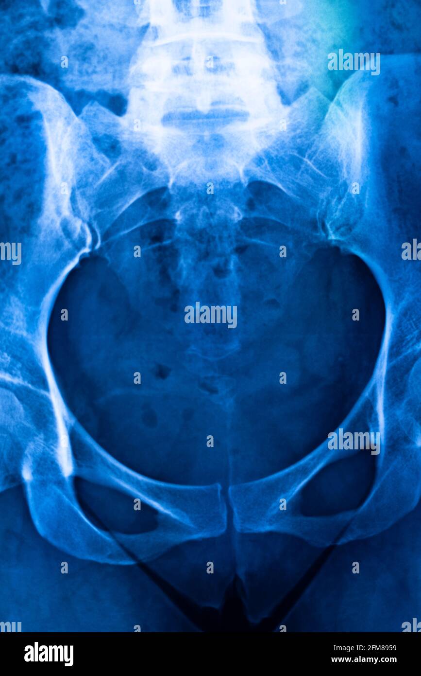 Pelvis girdle hires stock photography and images Alamy