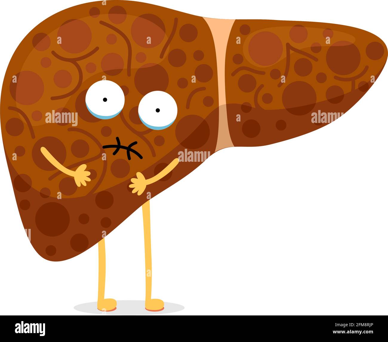 Sick unhealthy cartoon liver character suffers from jaundice or hepatitis and suffering pain. Human exocrine gland organ destruction concept. Vector hepatic mascot illustration Stock Vector