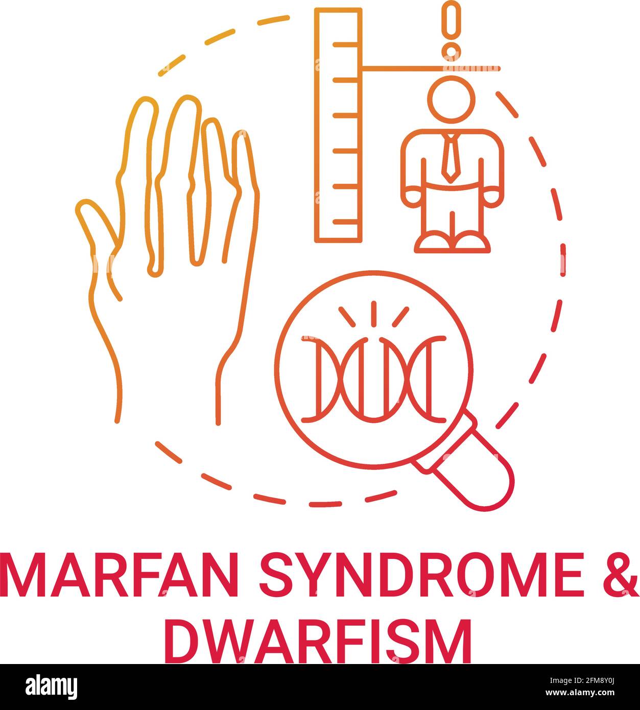 Marfan syndrome and dwarfism red gradient concept icon Stock Vector ...