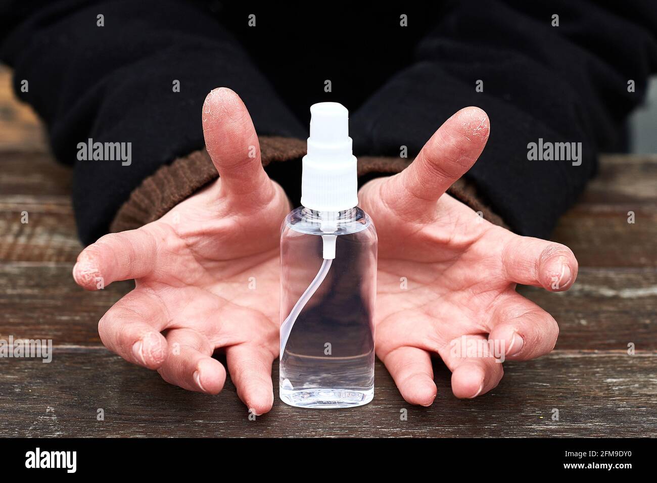 Dry hands cracked hires stock photography and images Alamy