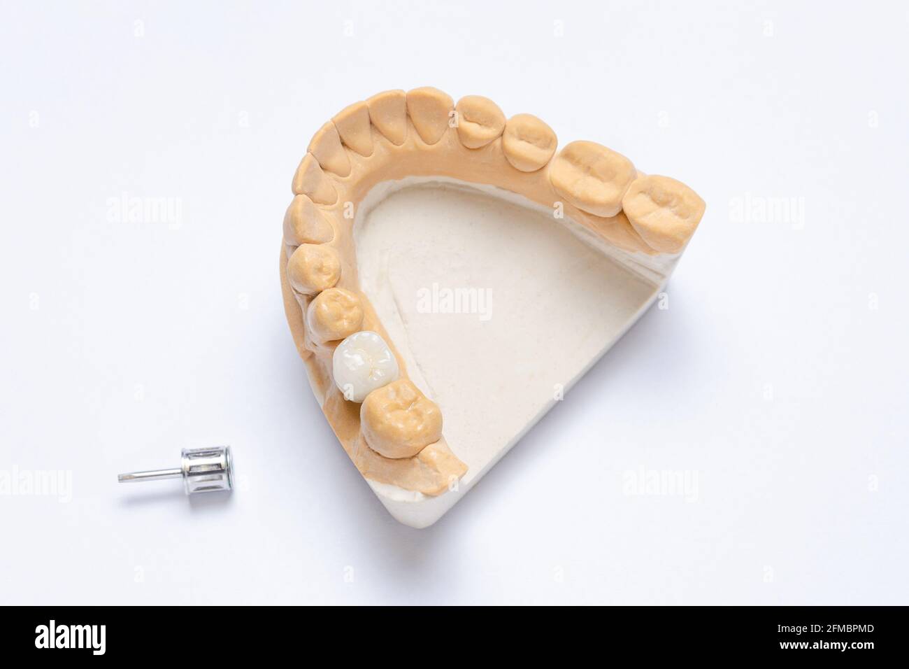 ceramic crown molar on a dental implant. lower jaw plaster model Stock