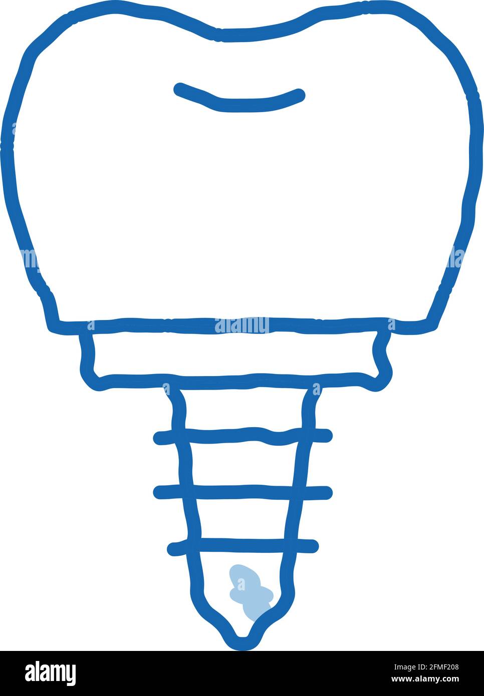 Dentist Stomatology Tooth Implant doodle icon hand drawn illustration ...