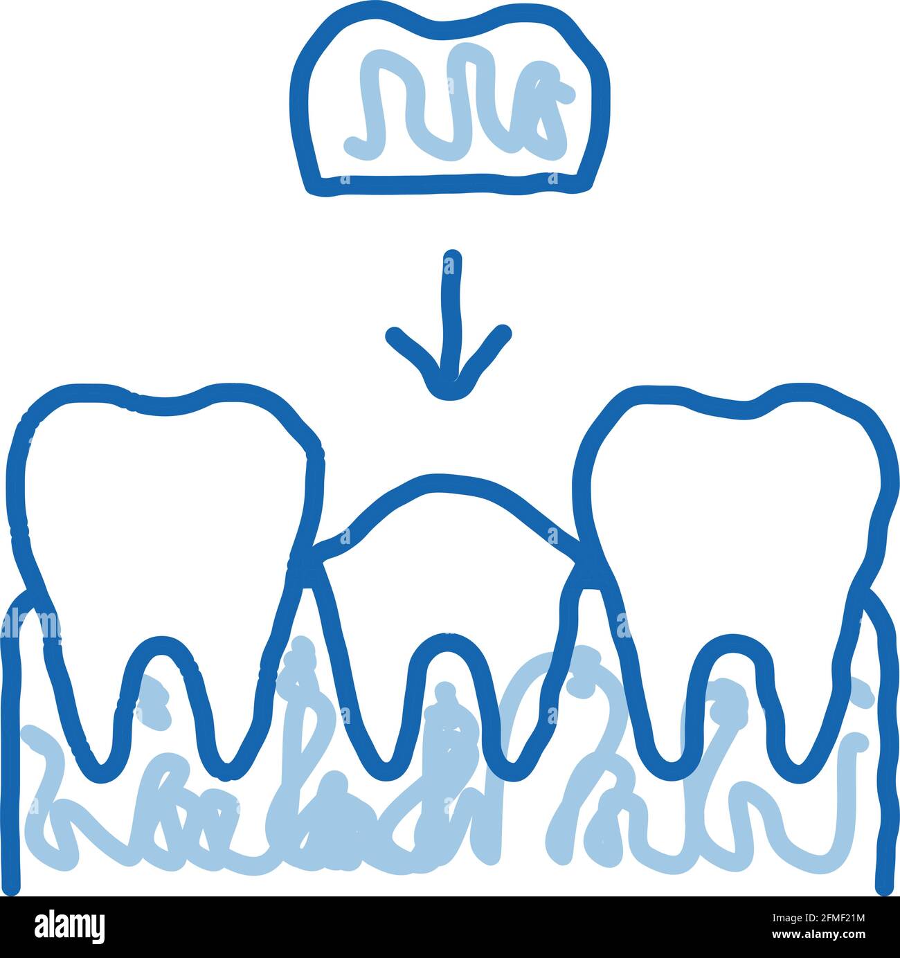 Stomatology Tooth Crown doodle icon hand drawn illustration Stock ...