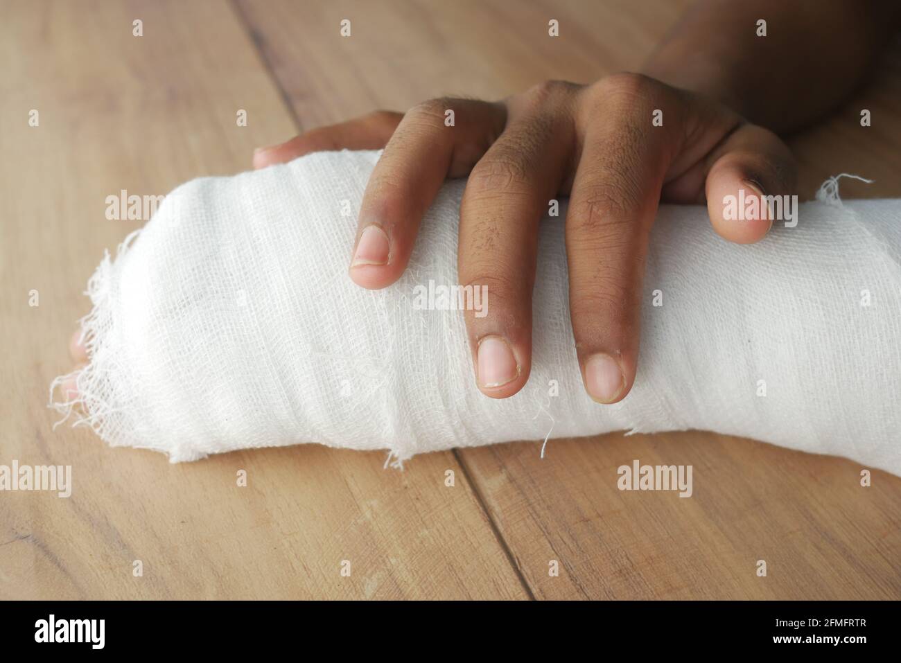 injured painful hand with bandage  Stock Photo