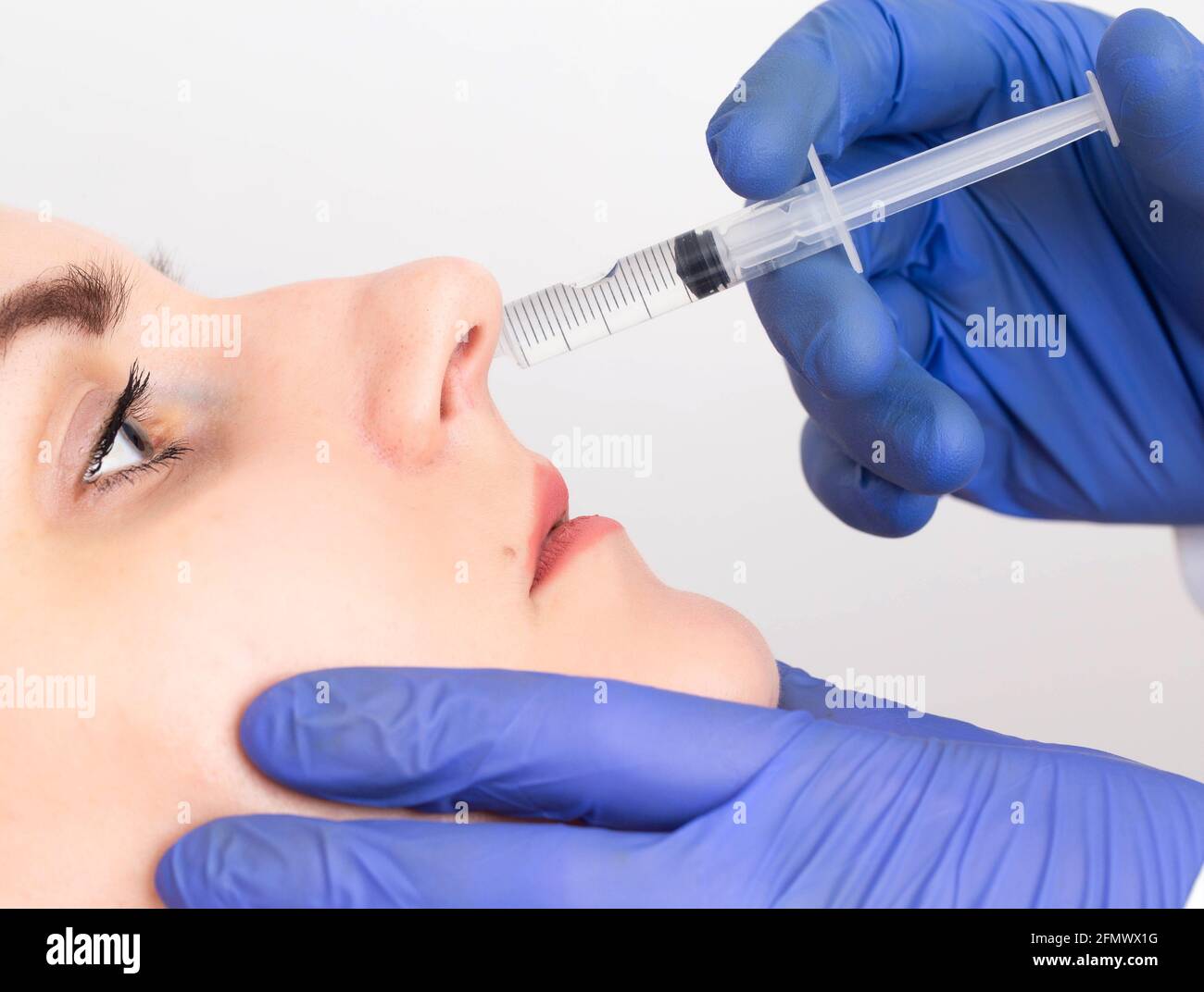 The doctor makes the procedure to the girl patient an intranasal block, close-up. Treatment concept for dry and burning nose, endonasal Stock Photo