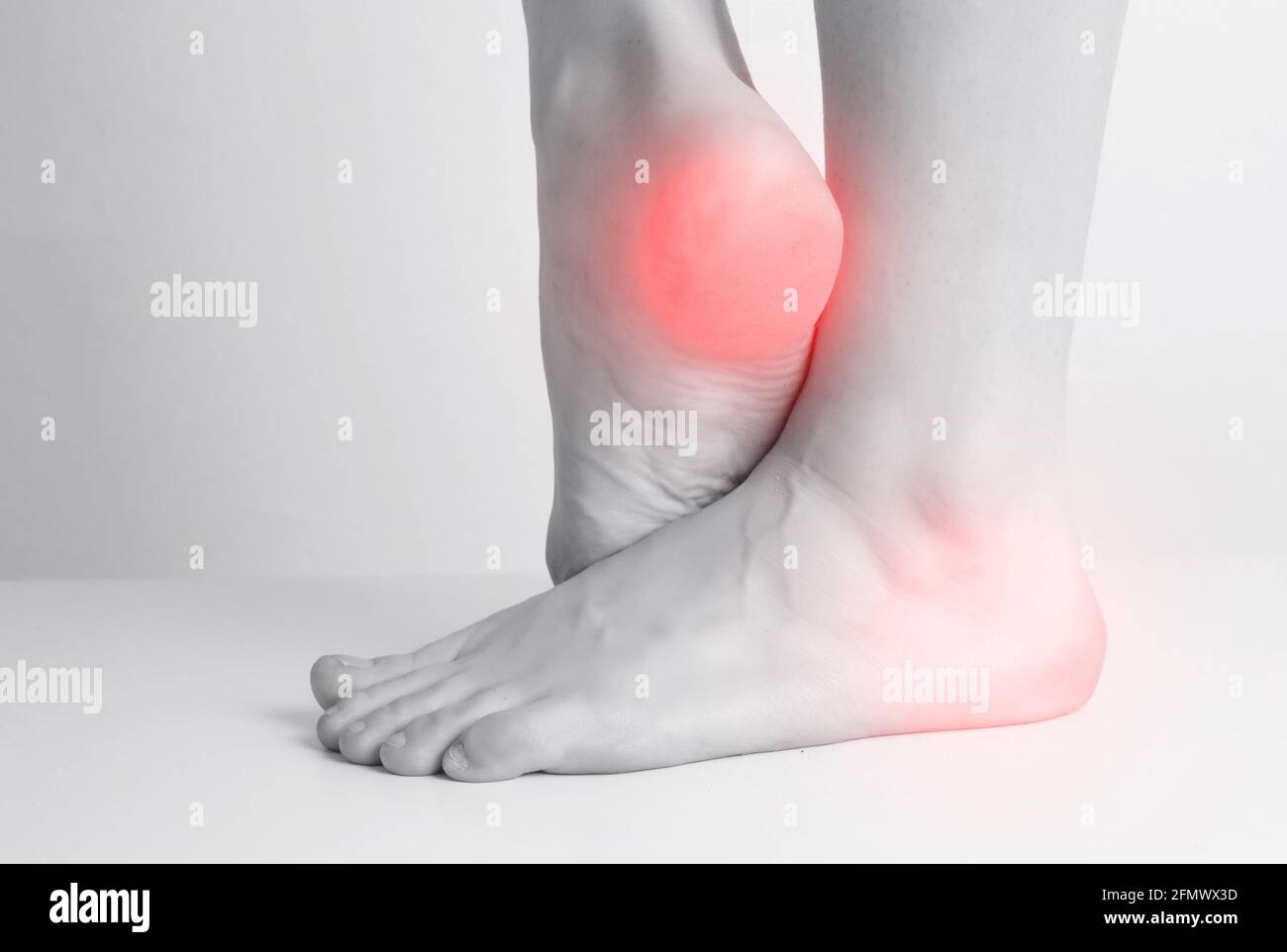 Black and white photograph with a red heel in a person. Heel pain concept. Osteoprosis and leg cramps Stock Photo