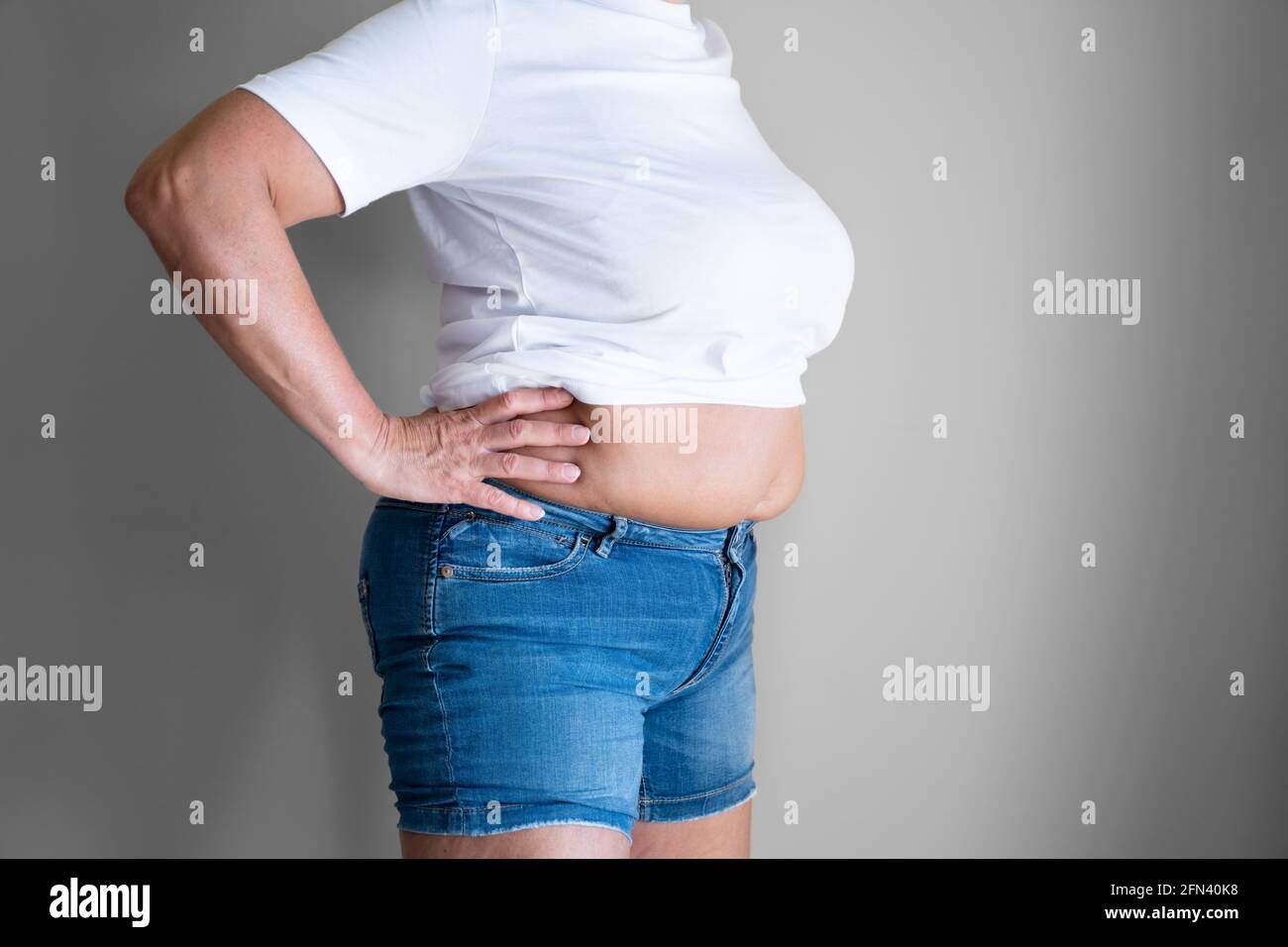 Fat Woman Belly Button And Body On Diet Stock Photo
