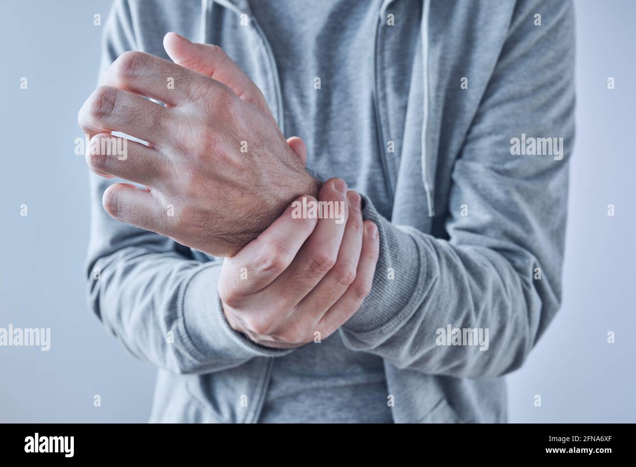 Inflammatory arthritis hires stock photography and images Alamy