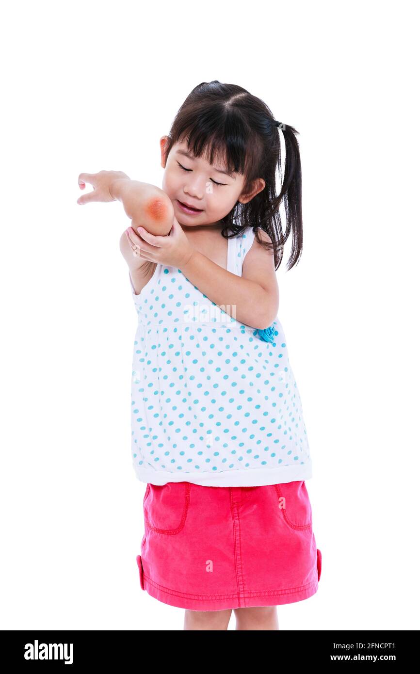 Sad japanese child in pink skirt injured at elbow. Pretty girl looking bruise. Isolated on white background. Studio shot. Human healthcare and problem Stock Photo