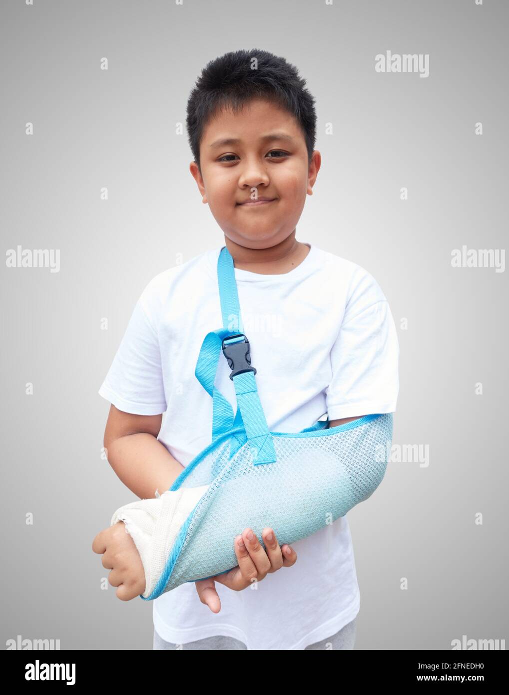 Child with a broken arm after accident Stock Photo Alamy
