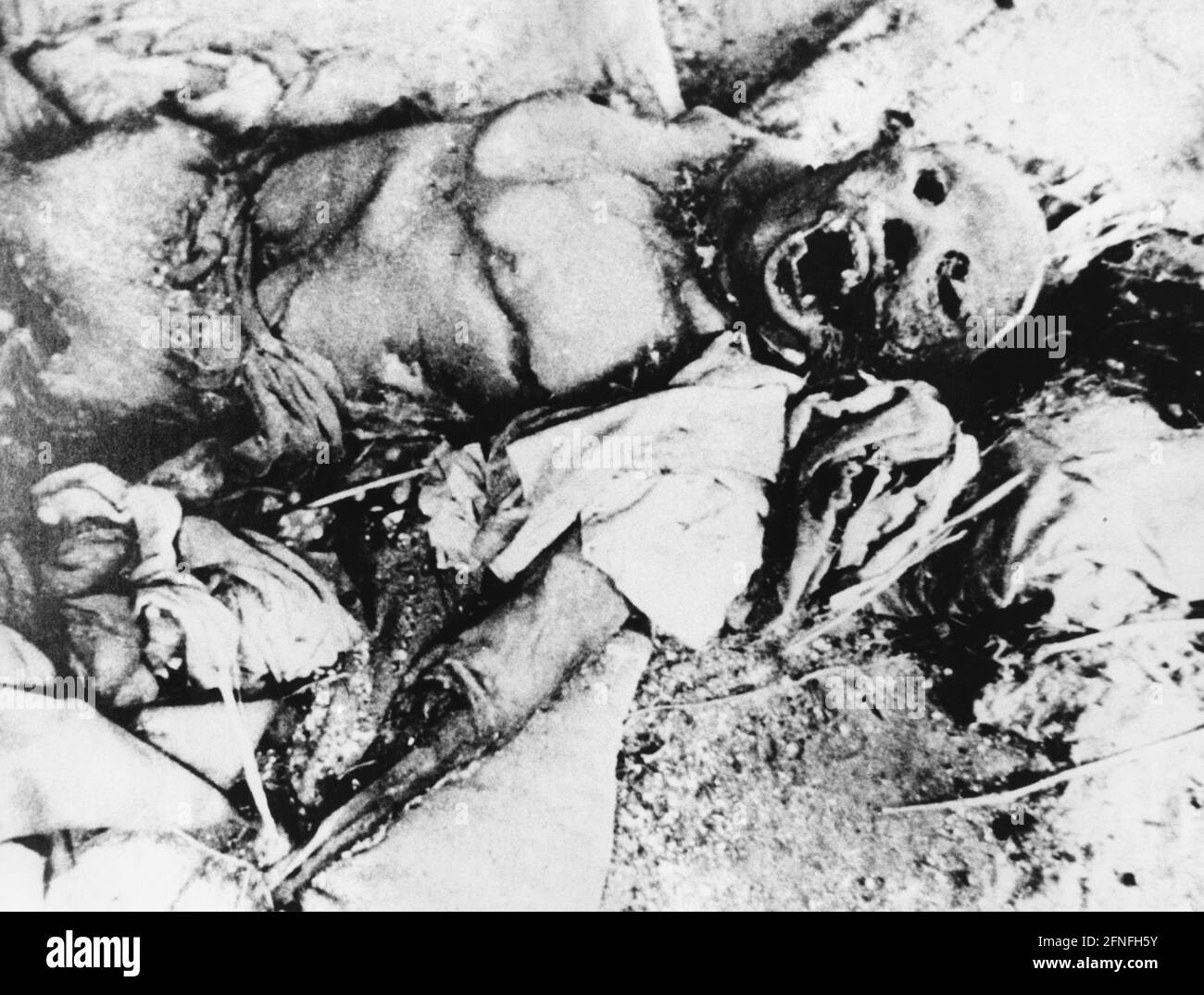 The body of a victim of the atomic bombing in Nagasaki during World War II. [automated translation] Stock Photo