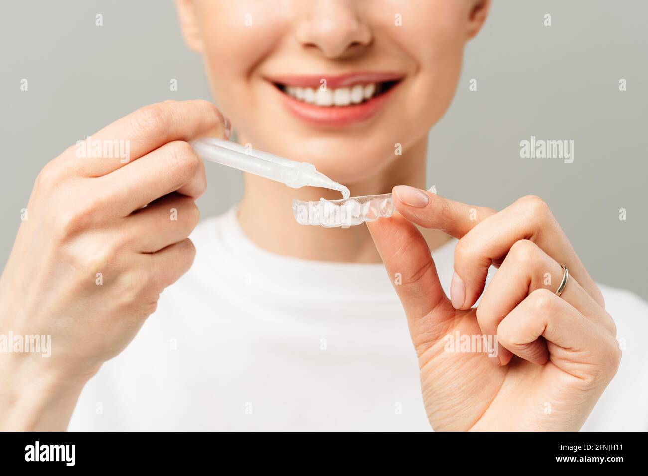 A young woman does a home teeth whitening procedure. Whitening tray