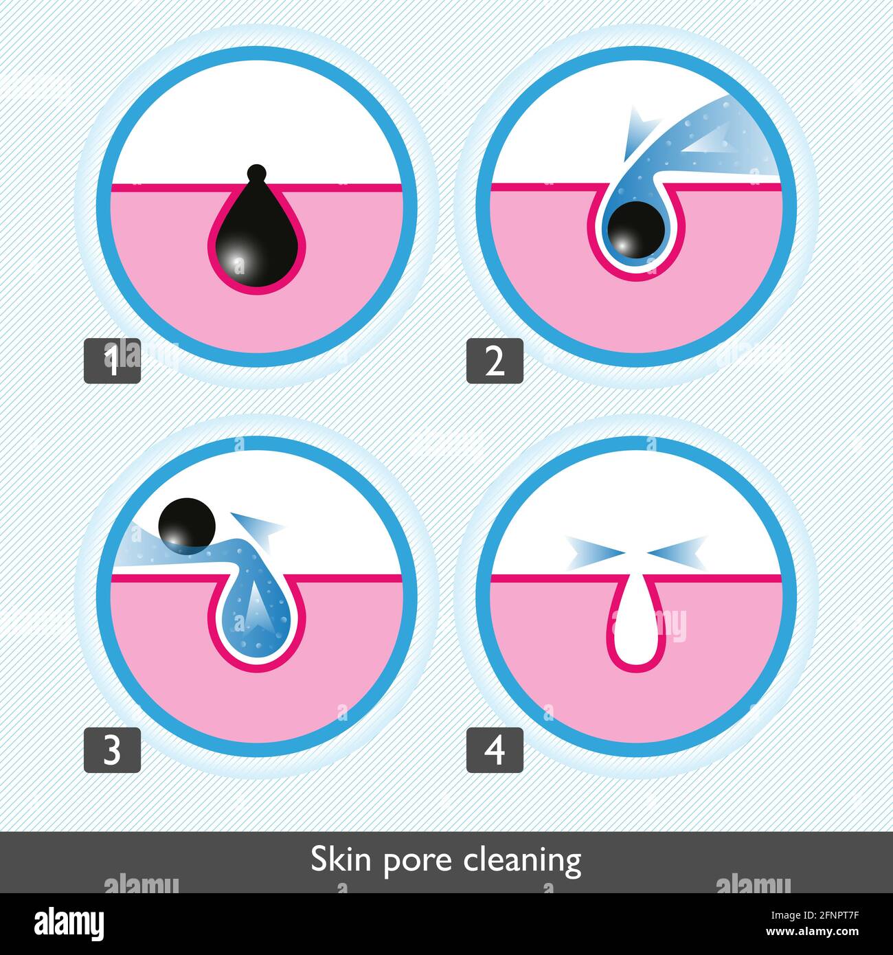 Skin pore cleansing process icons. Facial treatments colored icons. Treatment of skin diseases, sebum removal and pores cleaning and narrowing. Medica Stock Photo