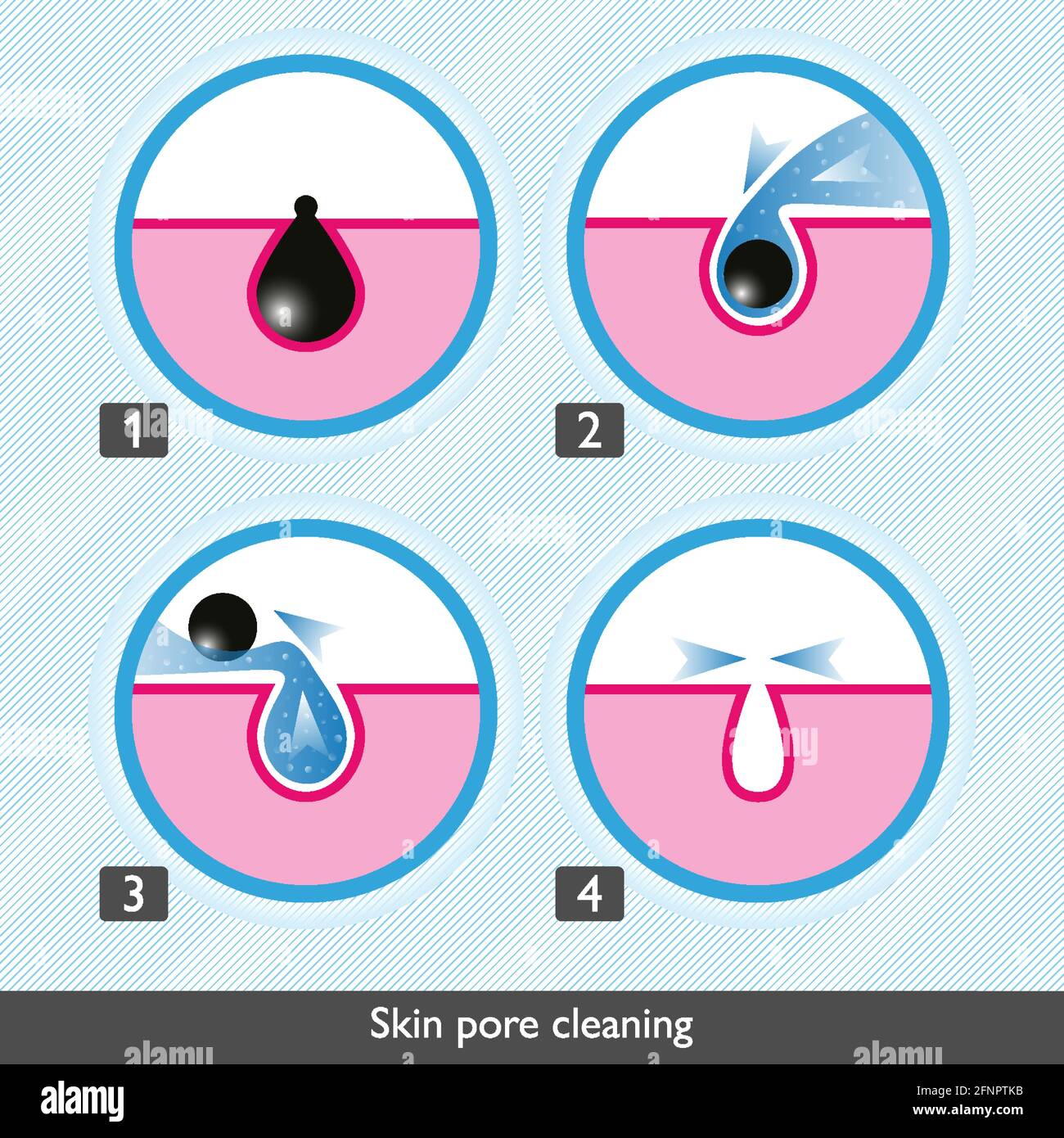 Skin pore cleansing process icons. Facial treatments colored icons. Treatment of skin diseases, sebum removal and pores cleaning and narrowing. Medica Stock Vector