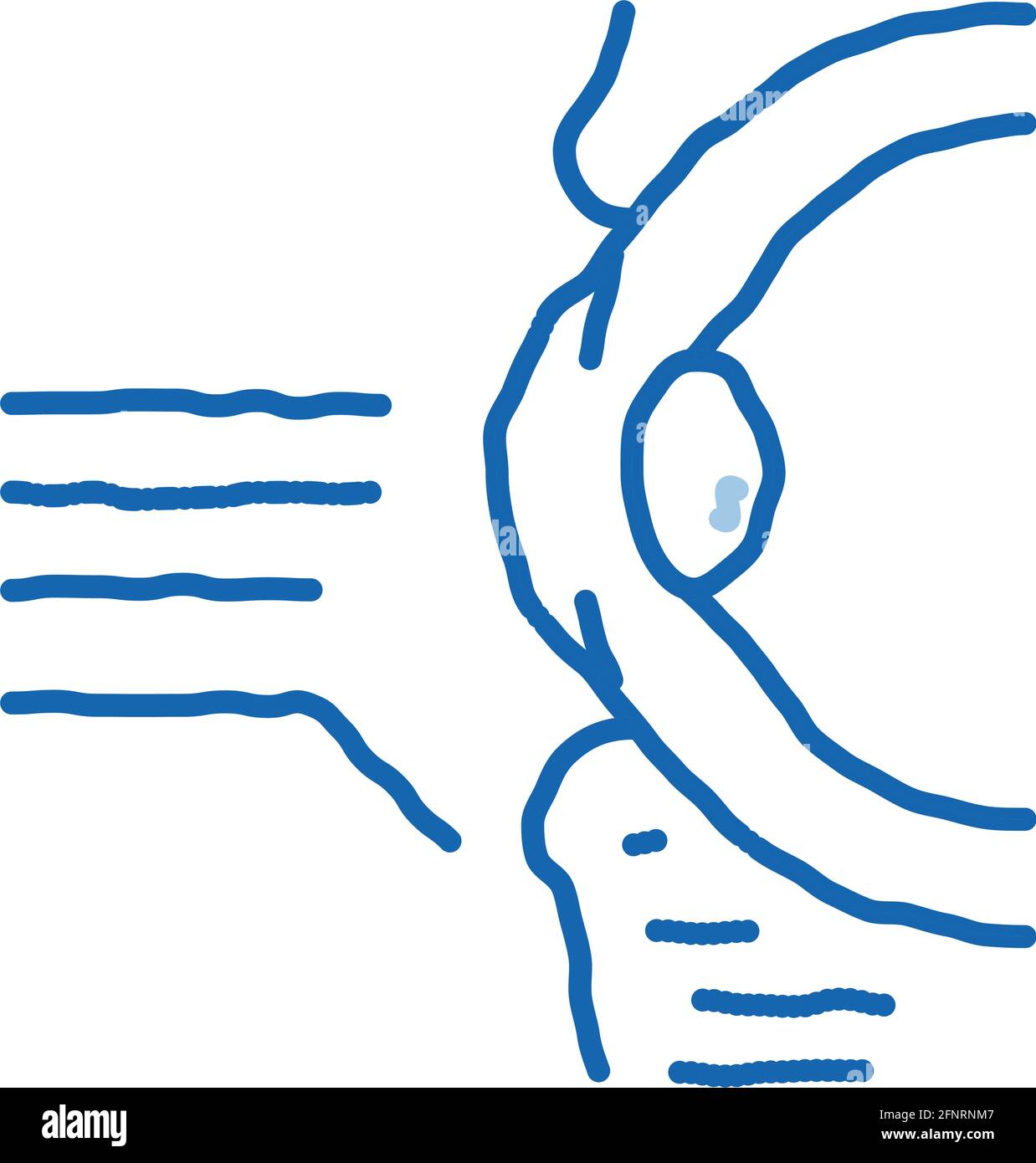 medical eyelid surgery doodle icon hand drawn illustration Stock Vector ...