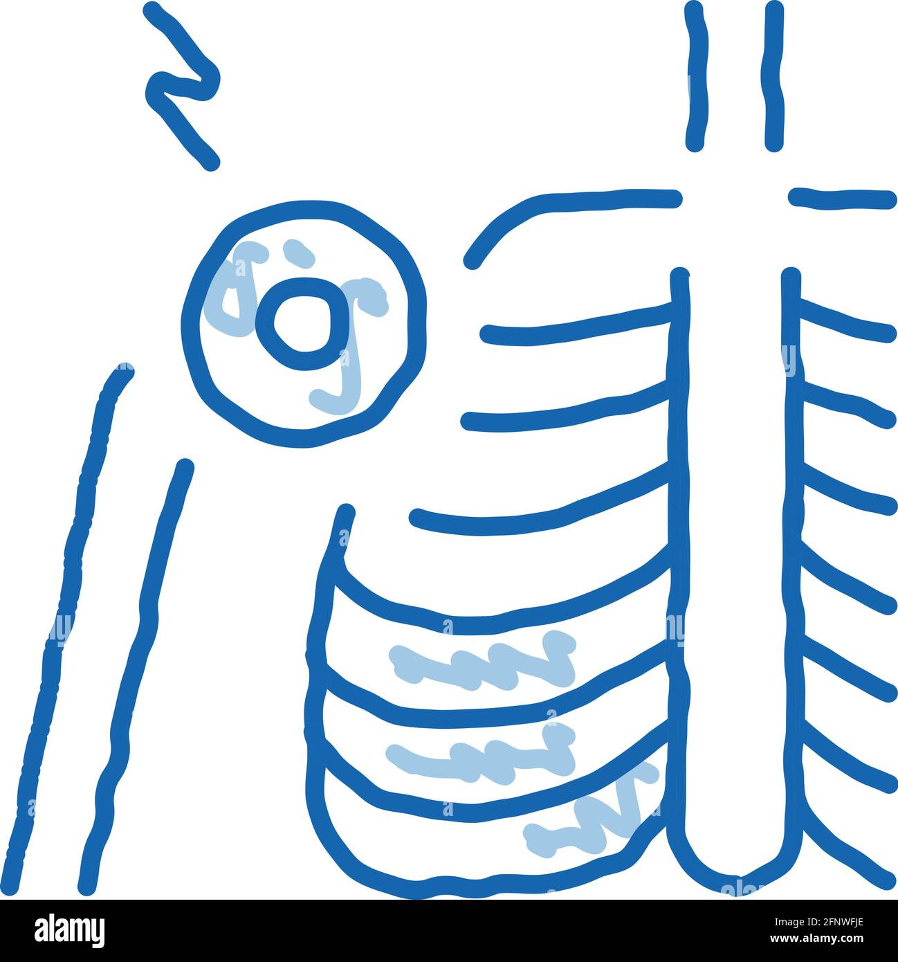 arthritis of shoulder joint doodle icon hand drawn illustration Stock ...