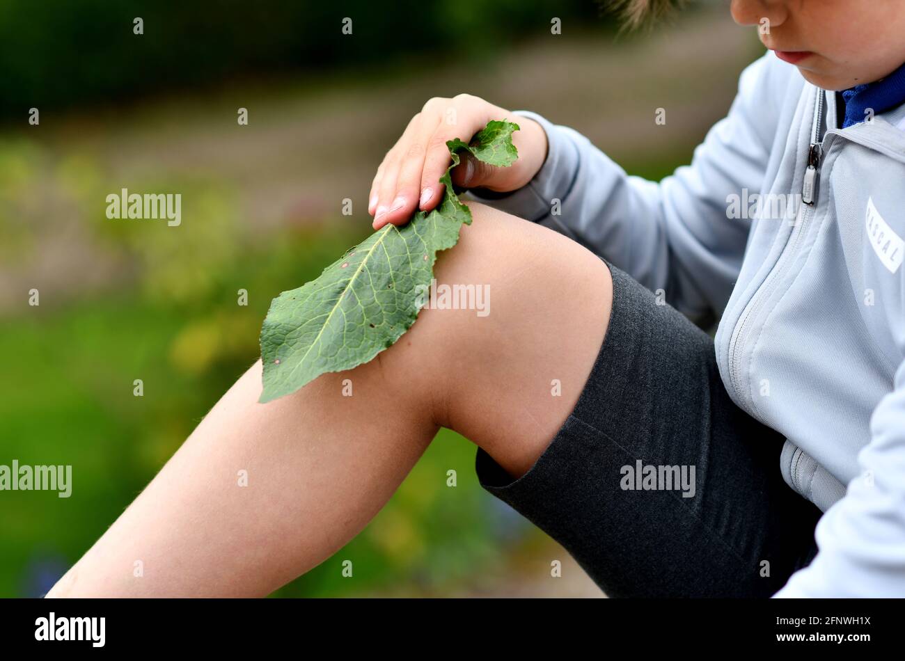 Young boy rubbing his knee with a dock leaf to treat a nettle sting Stock Photo