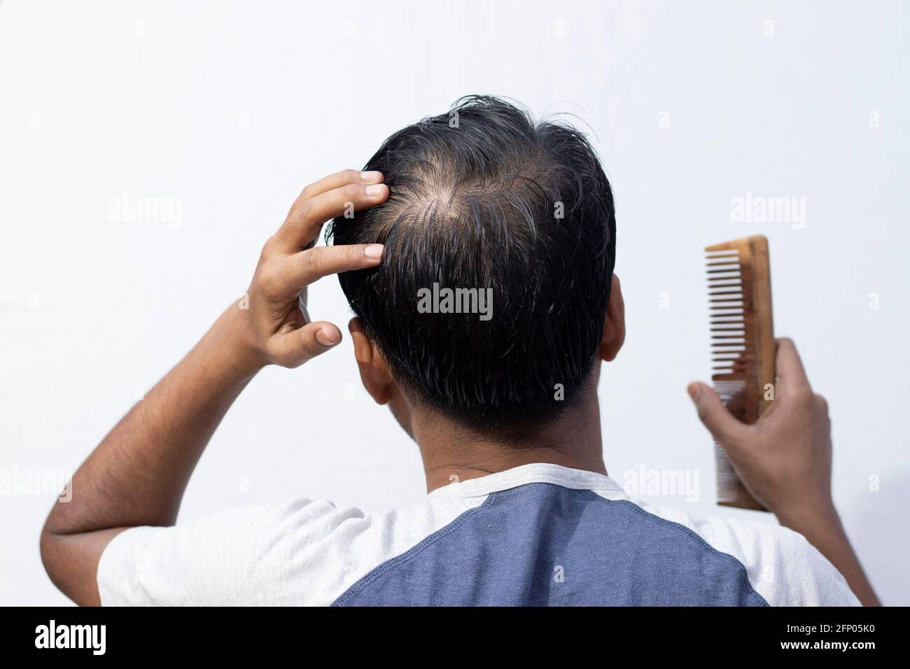 A middle aged Indian man showing his hair fall back facing with comb in  hand on white background Stock Photo - Alamy