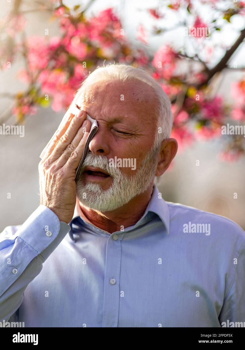 Senior man with allergy symptoms holding tissue on head in pain. Elrerly person suffering from hay fever in eye tearing Stock Photo