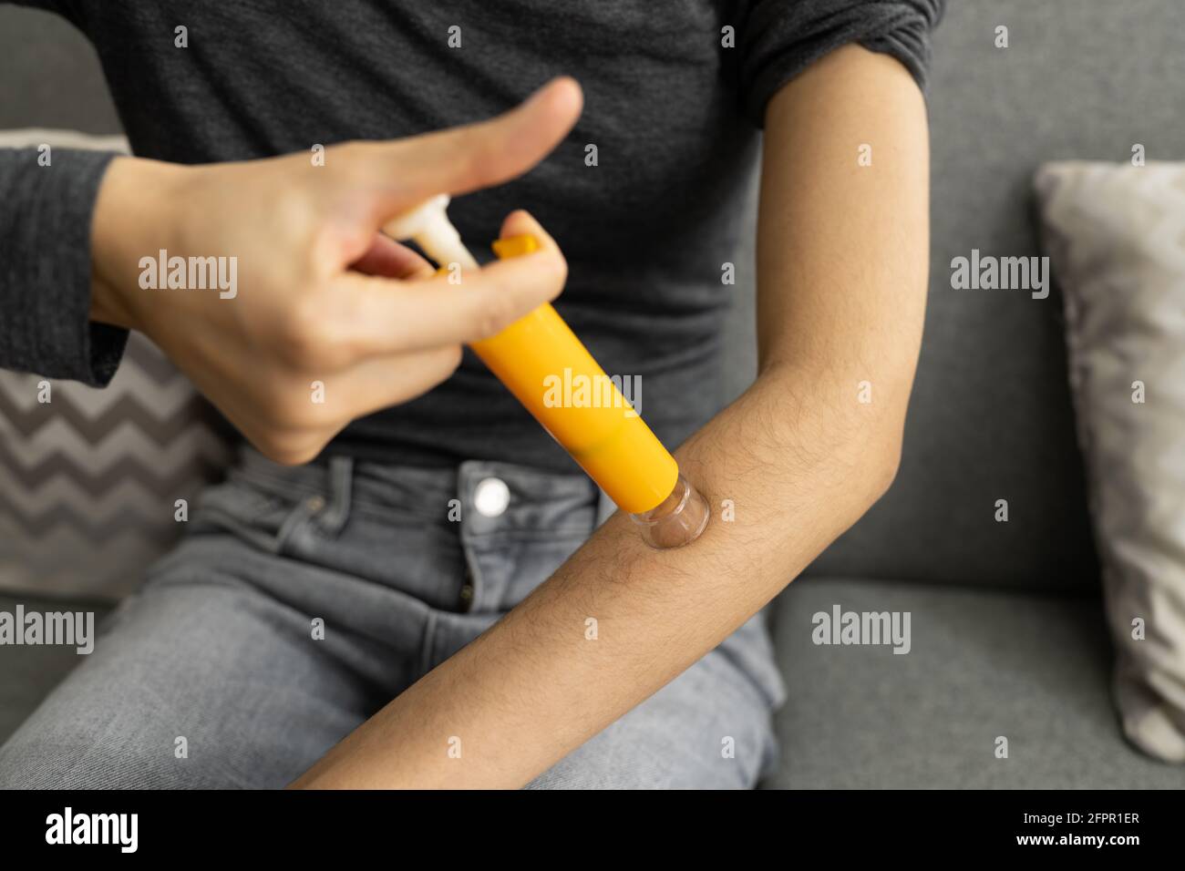 Bug bite suction tool and venom extractor stock photo alamy