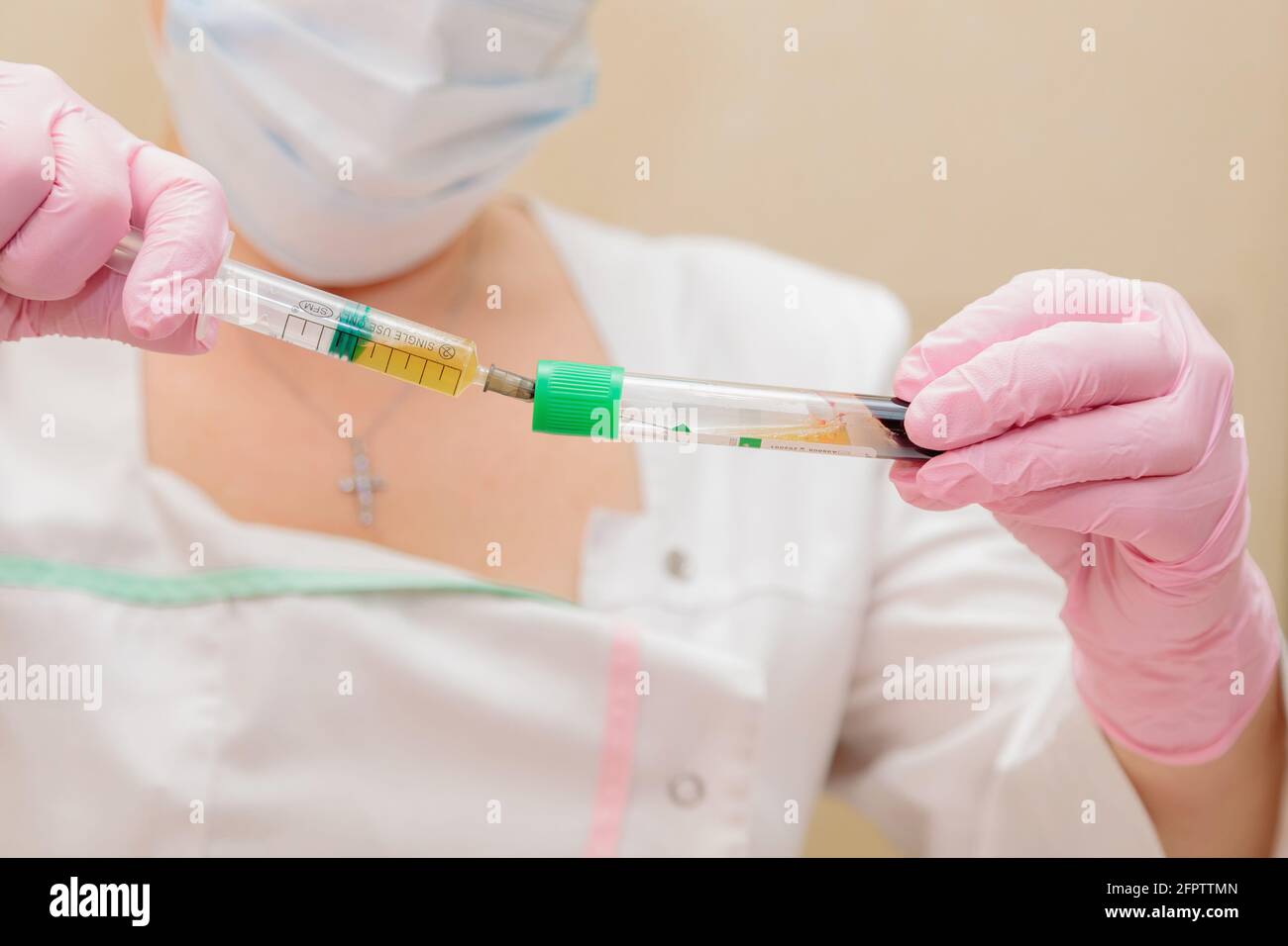 The specialist draws out the blood plasma from the test tube using a syringe. Plasmolifting, medical cosmetology Stock Photo