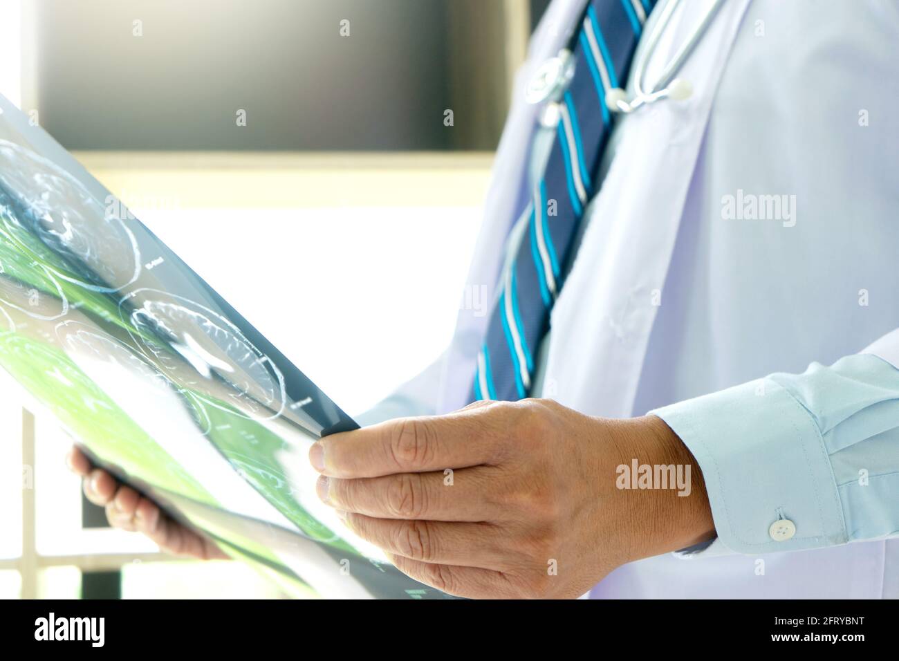 Doctor looking to the x-ray film , look for brain detail for find the way to get the patient be well. Stock Photo