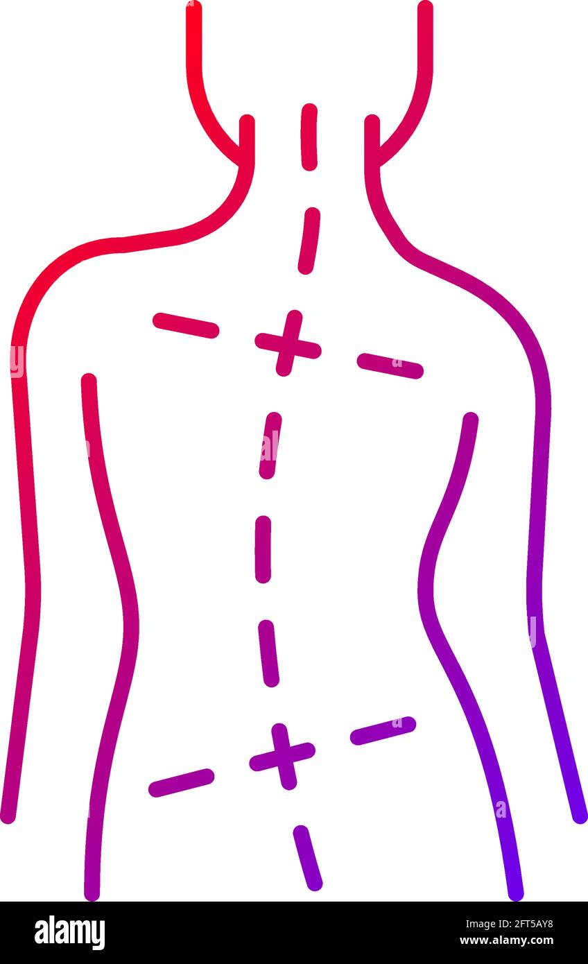 Uneven hips and shoulders gradient linear vector icon. Abnormal curve