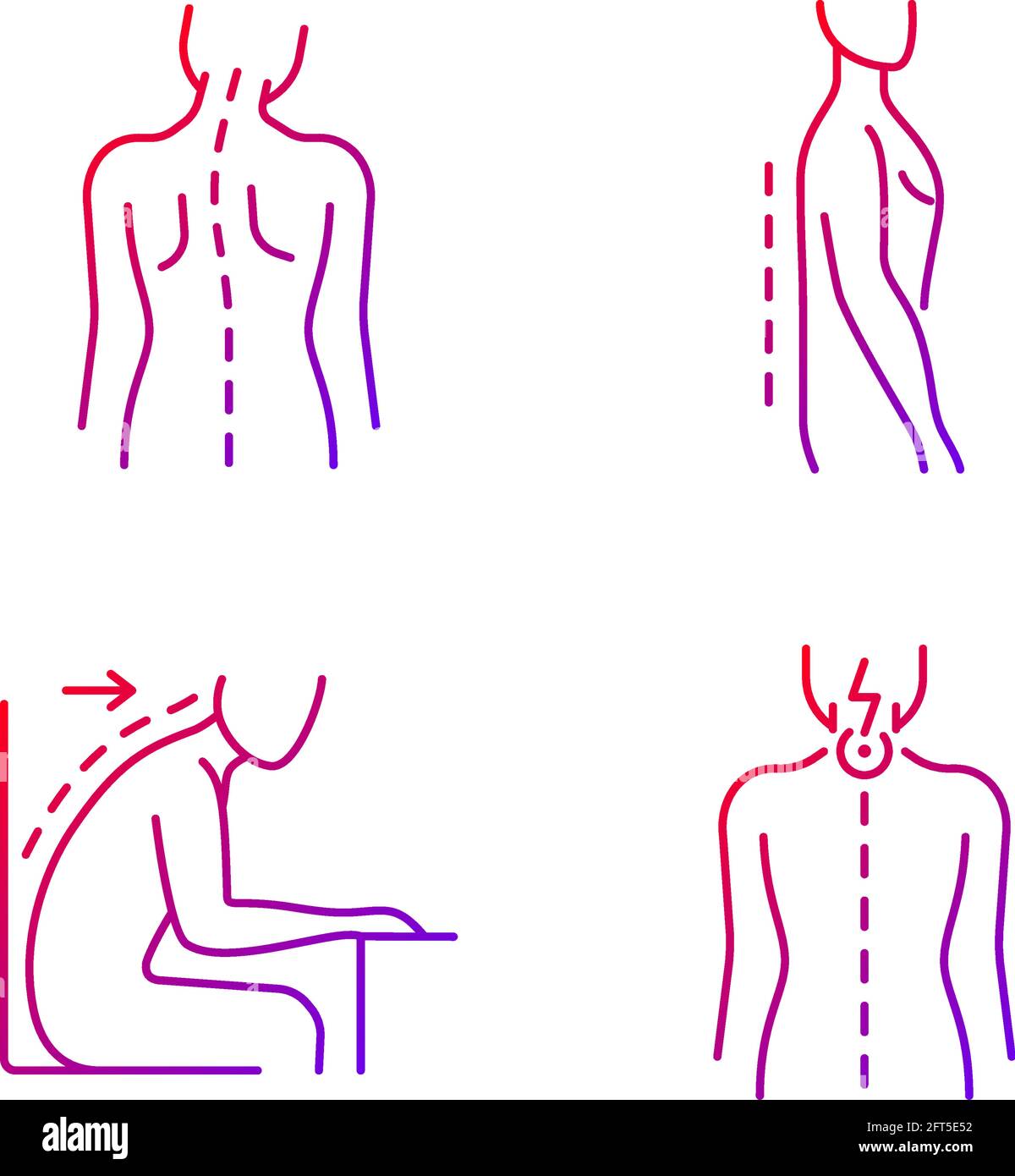 Bad posture problems gradient linear vector icons set. Head tilt. Flatback  syndrome. Slouching. Neck pain. Thin line contour symbols bundle. Isolated  Stock Vector Image & Art - Alamy