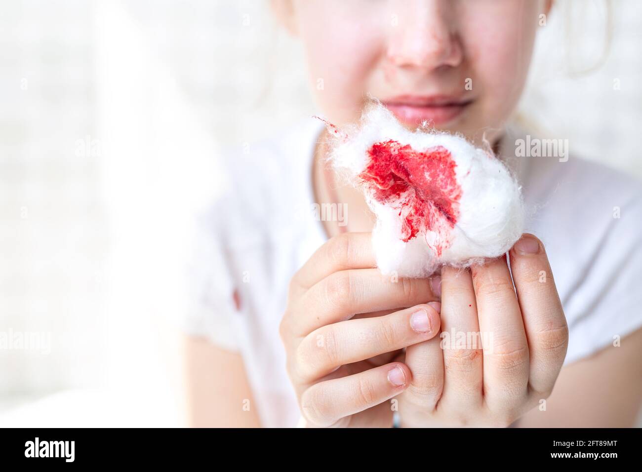 Bloody nostrils hires stock photography and images Alamy