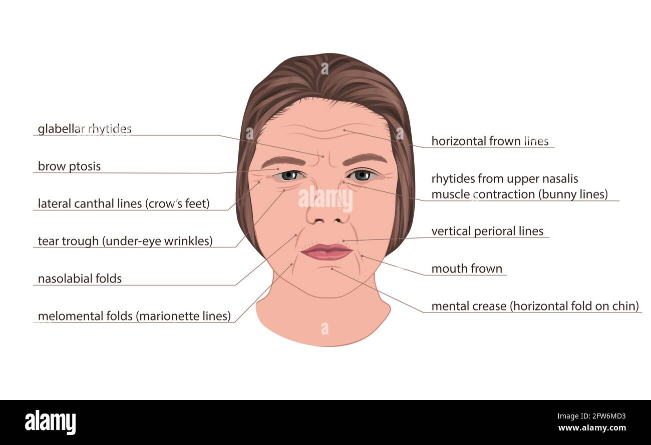 Facial wrinkles, illustration Stock Photo