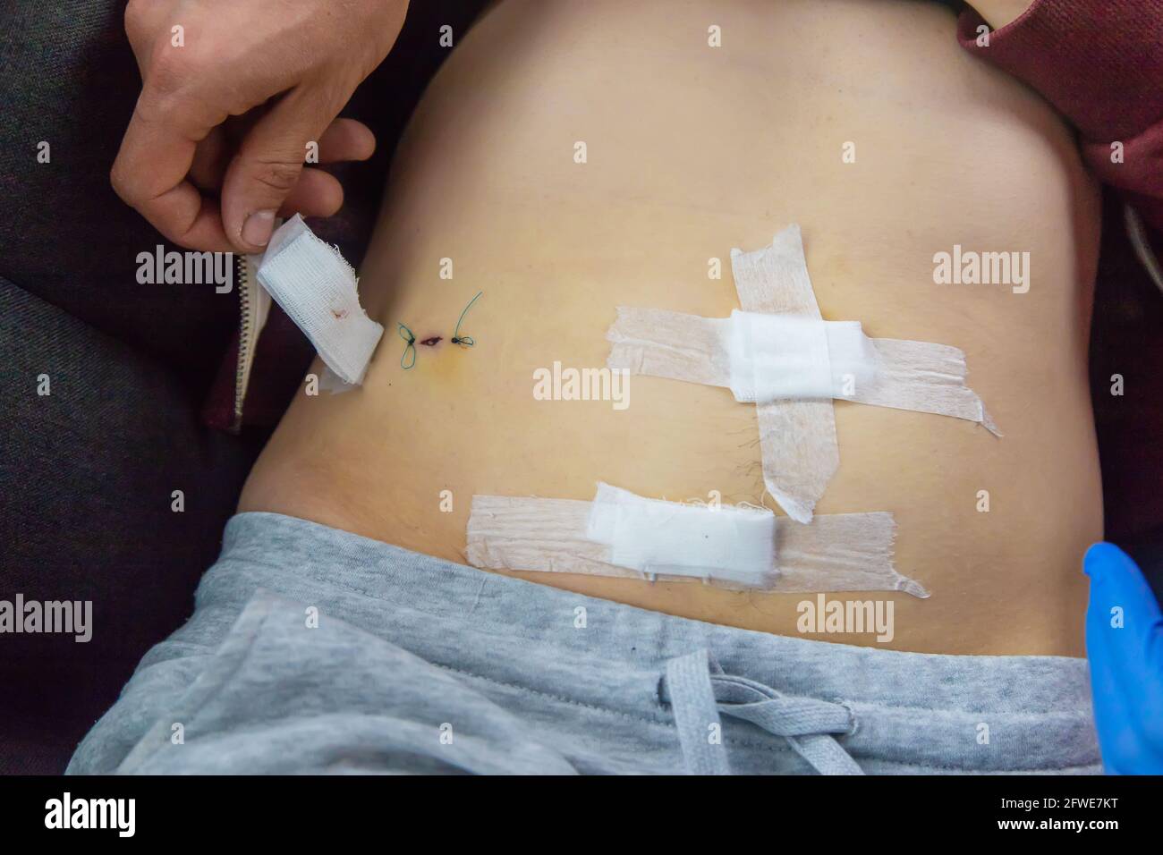 Examination of the patient by a doctor after removal of the appendix