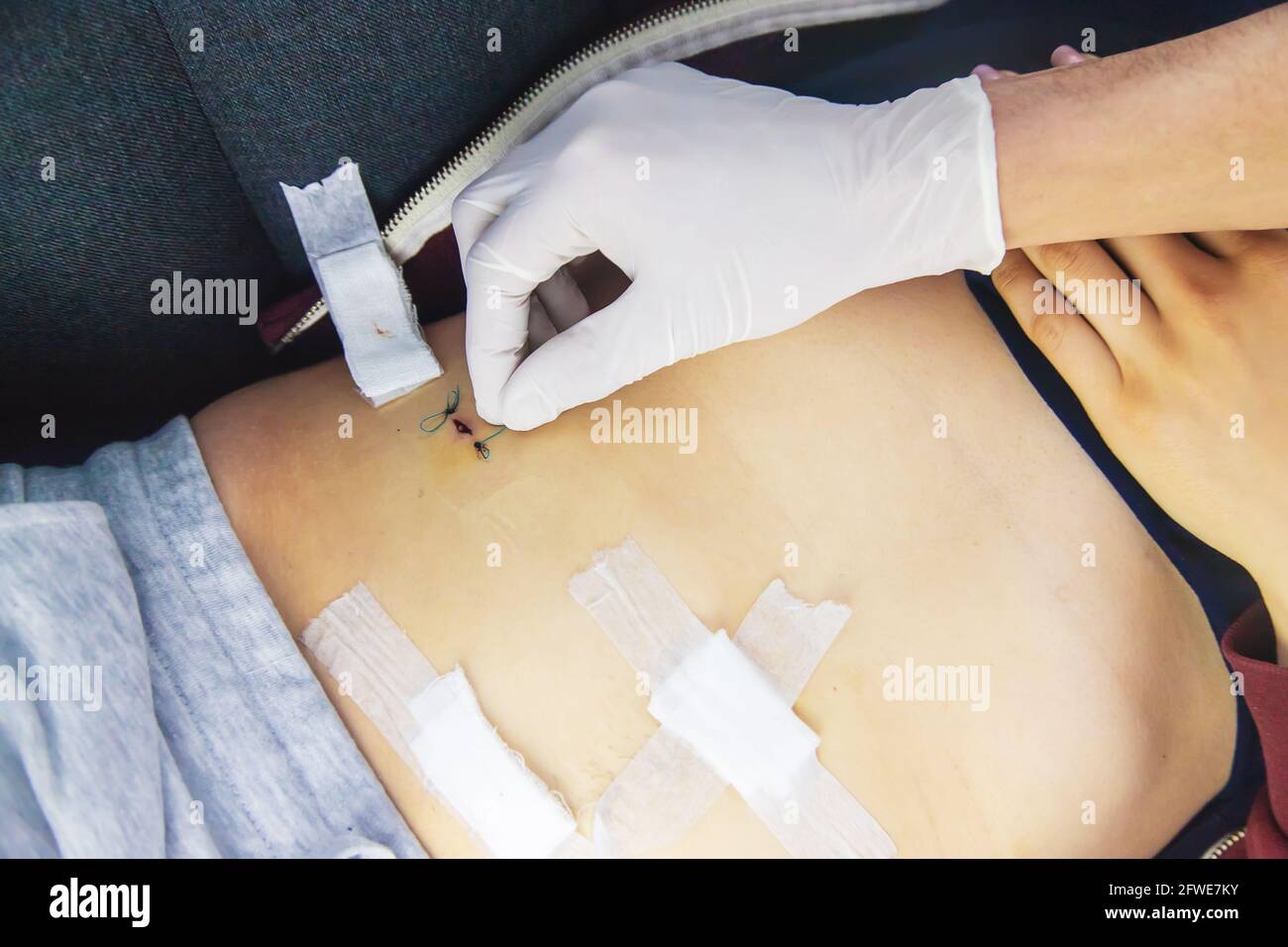 Examination of the patient by a doctor after removal of the appendix ...