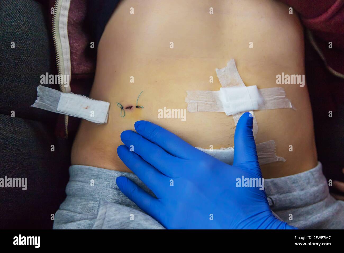 Examination of the patient by a doctor after removal of the appendix ...