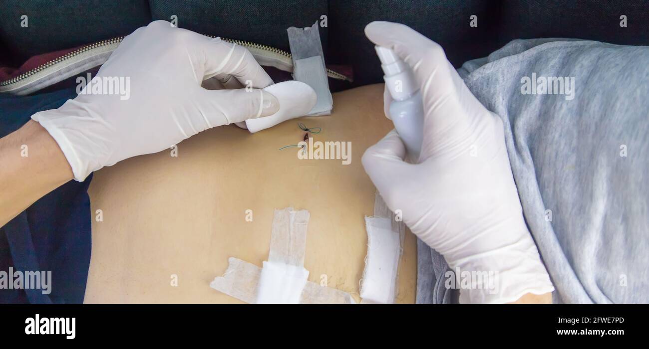 Examination of the patient by a doctor after removal of the appendix ...