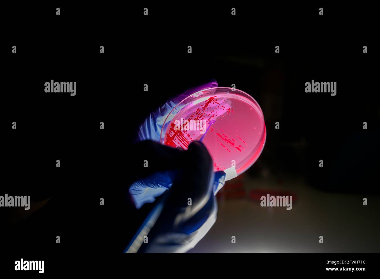Reasercher picking up colony of a red bacterial culture from pink