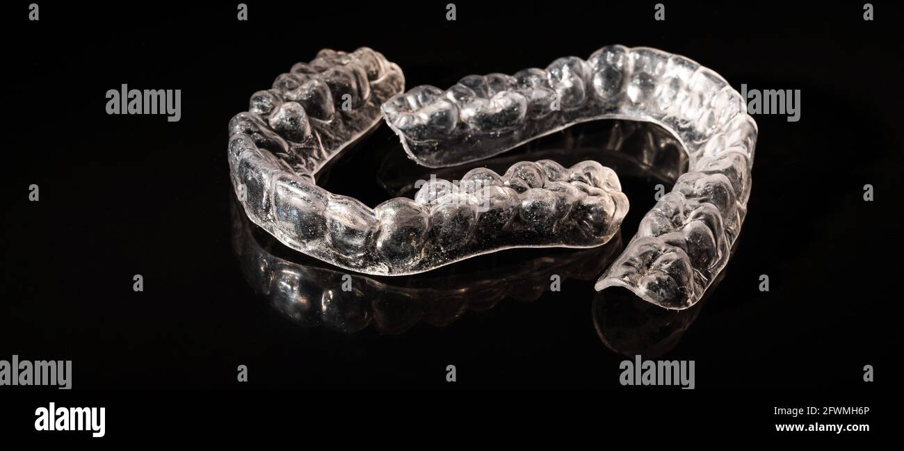 Removable plastic retainers for bite correction on a black background