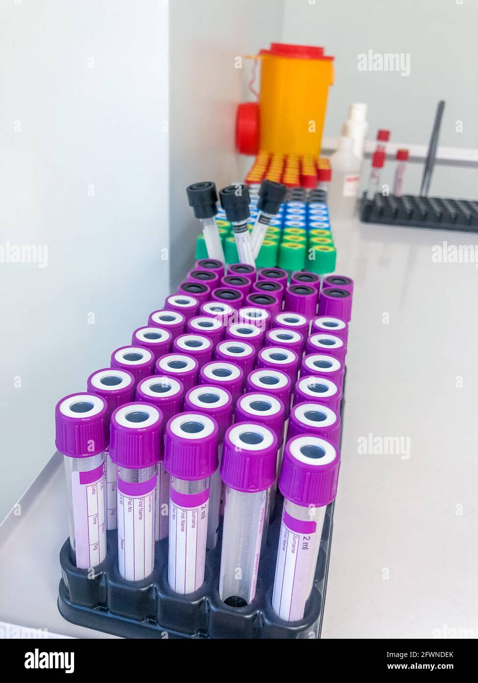 Medical research in a hospital laboratory. Medical equipment. Blood