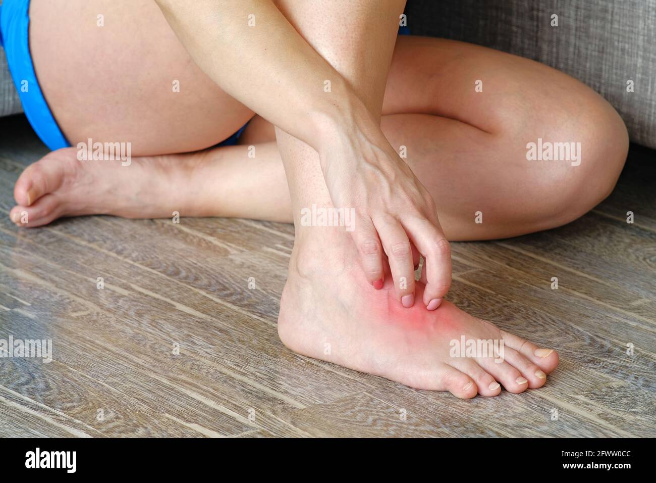 A woman scratches an inflamed spot on her leg. Lichen on the leg on a red background Stock Photo