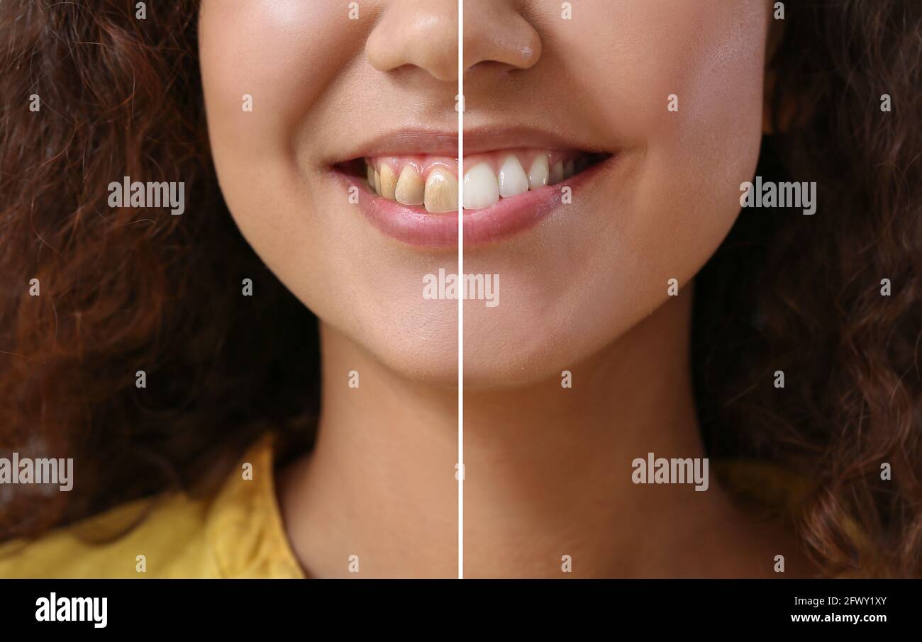 Scale polish dentist woman hires stock photography and images Alamy