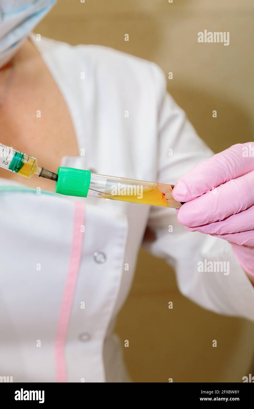 The specialist draws out the blood plasma from the test tube using a syringe. Plasmolifting, medical cosmetology Stock Photo