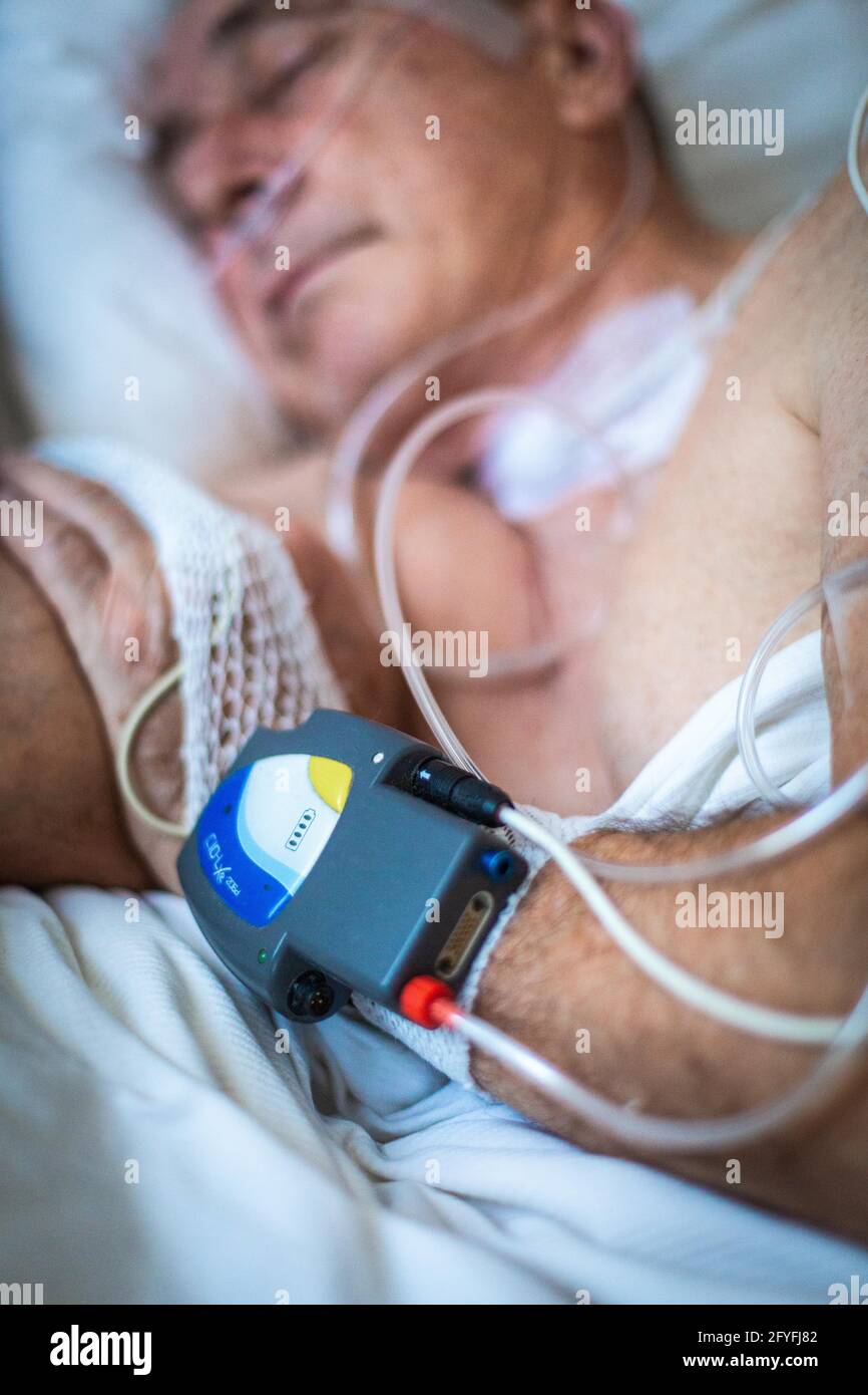 Simplified polysomnography at home, recording the level of oxygen saturation in the blood (nocturnal oximetry) and other parameters to detect the pres Stock Photo