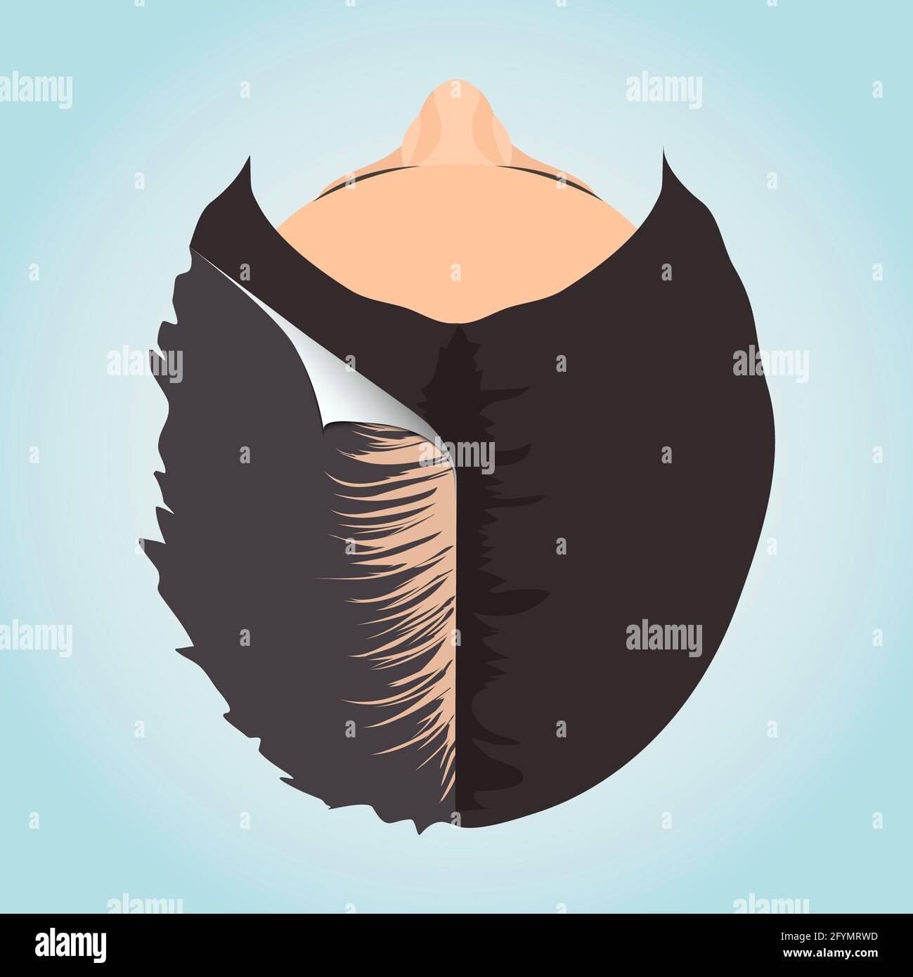 Hair loss treatment for women, conceptual illustration Stock Photo