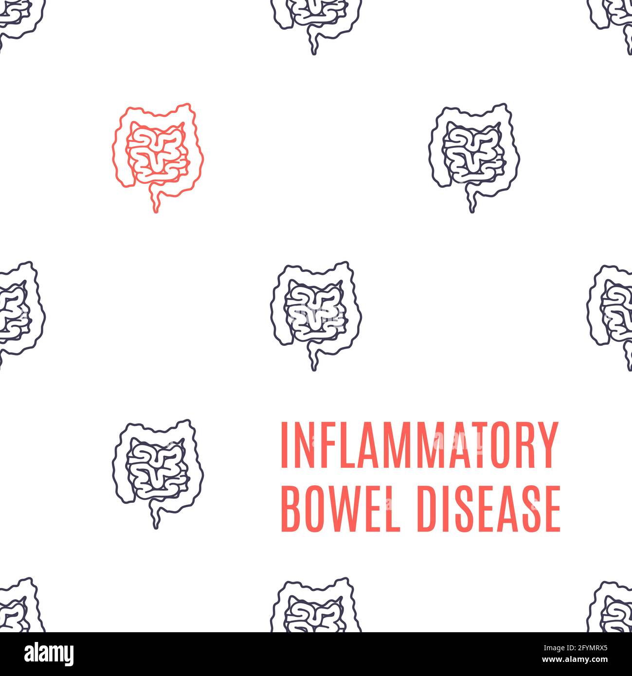Inflammatory bowel disorder,  illustration Stock Photo