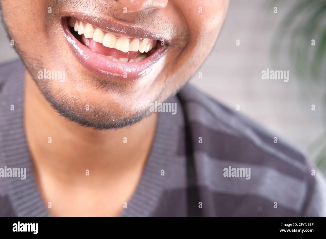 young man open mount checking his teeth  Stock Photo