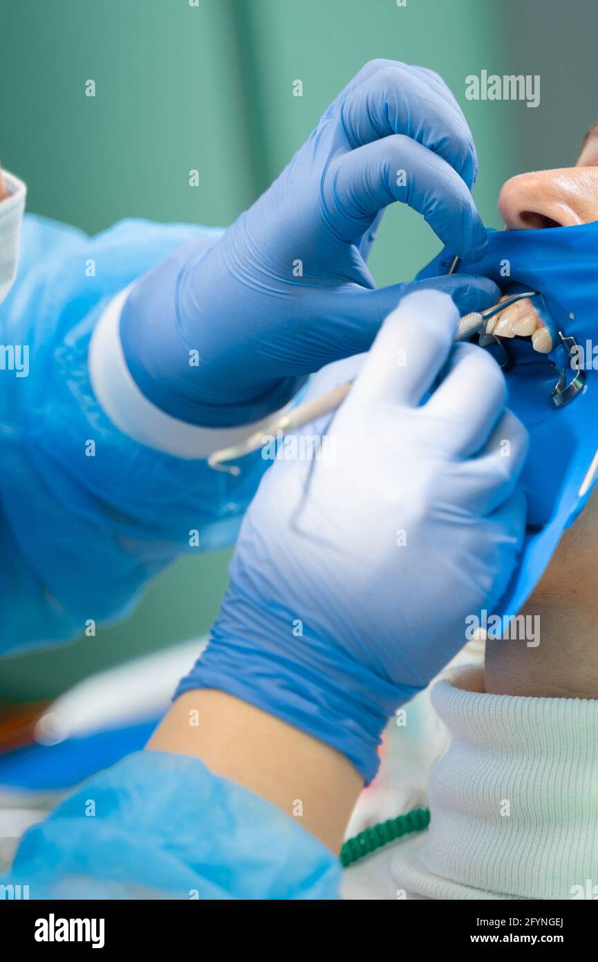 Dental dam hires stock photography and images Alamy