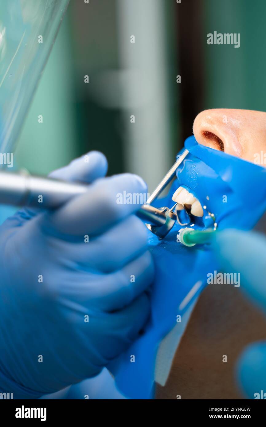 Dental treatment cofferdam in stomatology. Dentist using dental dam for