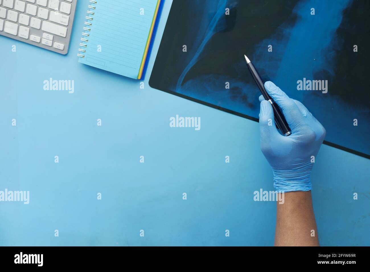 xray photography , digital tablet on blue background  Stock Photo