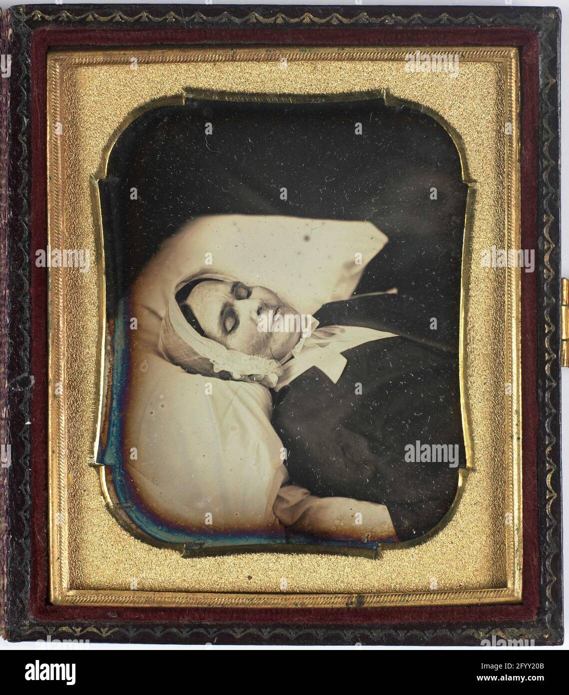 Post-mortem from a woman. Stock Photo