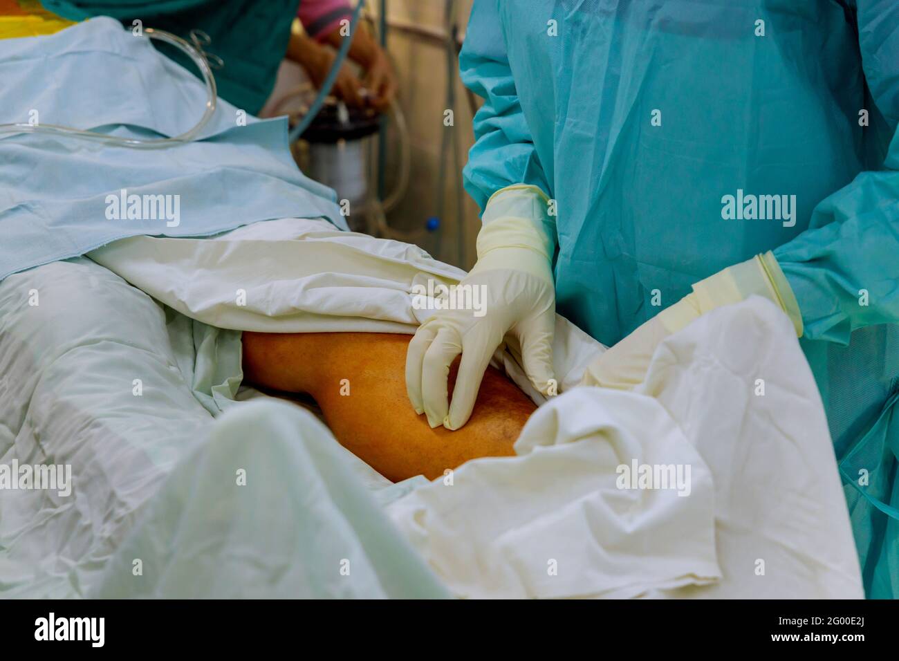 Doctor surgeon prepared leg for surgery with hospital emergency operating room Stock Photo